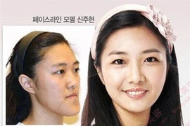 Những thay đổi khó tin nhờ công nghệ làm đẹp Hàn Quốc