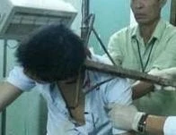 Đối tượng dùng cào sắt bổ vào đầu công an ra đầu thú