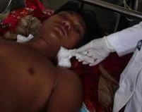 Nam công nhân bị thanh sắt xuyên từ cổ xuống ngực