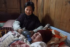 Sống sót 5 năm nhờ máy thở tự chế