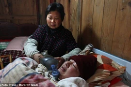 Sống sót 5 năm nhờ máy thở tự chế