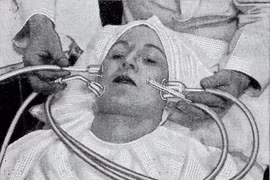 Kỳ quái những cách làm đẹp thời trung cổ