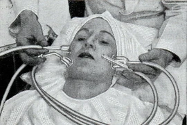 Kỳ quái những cách làm đẹp thời trung cổ