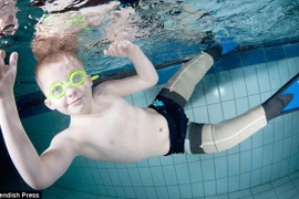 Kình ngư nhí đoạt nhiều huy chương với đôi chân giả