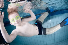 Kình ngư nhí đoạt nhiều huy chương với đôi chân giả