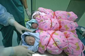 Cận cảnh một ca sinh 3 kỳ diệu