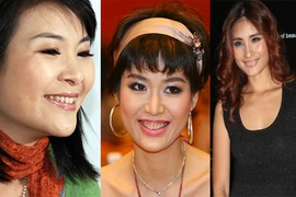 Những hàm răng “thế hệ tetracycline” của sao Việt