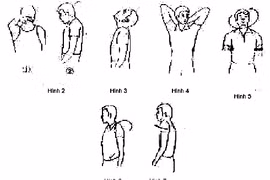 Bài tập giảm đau thoái hóa đốt sống cổ 