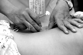 Khám phá những “phép” chữa bệnh cổ truyền