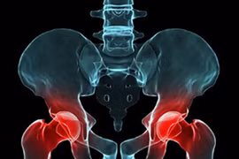 Viêm cột sống dính khớp dễ bị liệt tứ chi, lao phổi