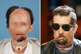 Thần kỳ những ca tái tạo mặt “quái nhân“