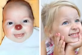 Những “vết bớt” kỳ quặc nhất quả đất