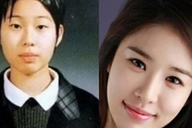 Sao Hàn xấu xí thời chưa “dao kéo“