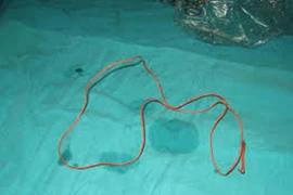 Bắt hung thủ liều lĩnh chích điện cướp tài sản