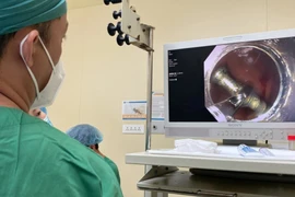 Bé 2 tuổi nuốt đinh sắt: Bác sĩ khuyến cáo gì?