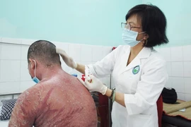 Bệnh vảy nến bị biến chứng nặng do dùng thuốc trôi nổi