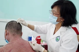 Trị vẩy nến bằng Đông y: Loạn sản phẩm, công dụng