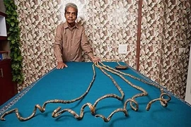 "Đứng hình" với những chuyện lạ đời nhất 2015