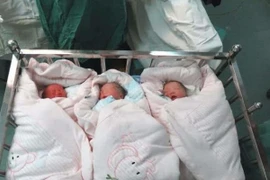 Thứ kỳ lạ "di chuyển" trong bụng mẹ sau sinh khiến bác sĩ cười lăn