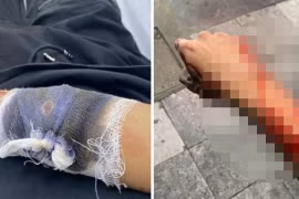 Truy bắt nhóm đối tượng chém người, cướp xe máy ở Nhà hát Lớn