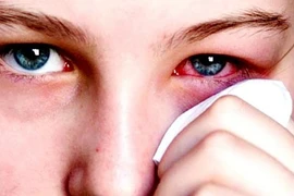 Ăn tôm sai cách khó tránh mắc bệnh vào thân