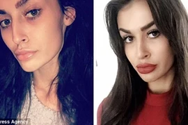 Người mẫu nữ có tử cung và ruột dính chặt vào nhau