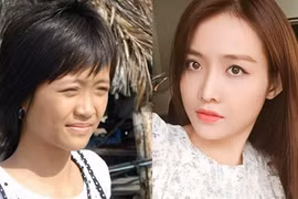 Soi nhan sắc trước và sau thẩm mỹ của thí sinh The Face 2017