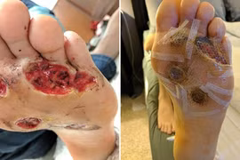 Suýt liệt chân vì tắm công cộng ở phòng tập gym