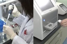 Thiết bị hiện đại có thể phát hiện 13 loại ung thư chỉ với một giọt máu