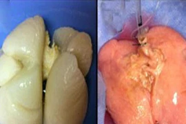 Lần đầu tiên tái tạo thành công phổi người