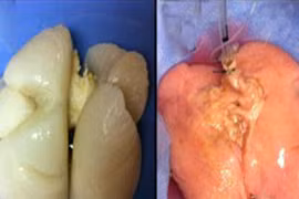 Lần đầu tiên tái tạo thành công phổi người