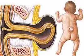 Bổ sung axit folic vào tháng thứ mấy của thai kỳ