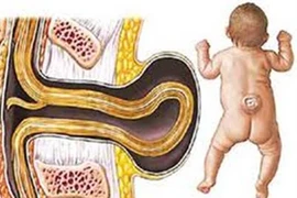 Bổ sung axit folic vào tháng thứ mấy của thai kỳ