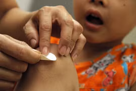 Chống muỗi cho trẻ bằng miếng dán lợi hại thế nào?