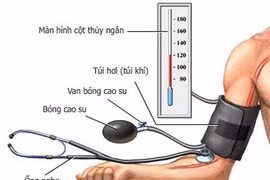 Nguyên do gây huyết áp lúc tăng lúc giảm 