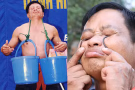 Dị nhân đâm móc sắt vào mắt để “xách” hai xô nước