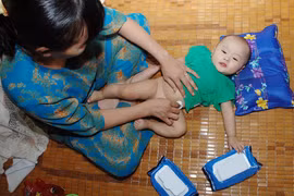 Chất cồn trong giấy ướt làm gia tăng da dầu