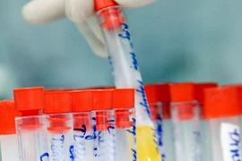 Xét nghiệm dương tính bệnh nhiễm khi mang thai