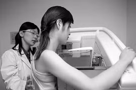 Vai trò của chụp vú trong chẩn đoán ung thư