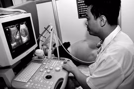 Viêm hô hấp trên khiến thai lưu