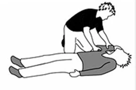 Biểu hiện của động kinh