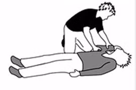 Biểu hiện của động kinh