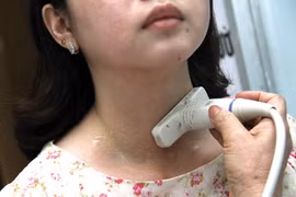 Dinh dưỡng cho bệnh nhân uống iốt phóng xạ