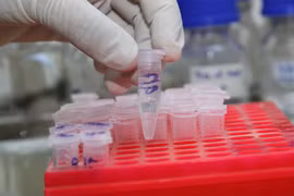 Giám định ADN trong xương chỉ chính xác 95%