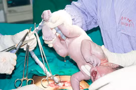 Phương pháp giúp phụ nữ bệnh tim sinh con 