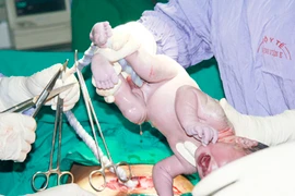 Phương pháp giúp phụ nữ bệnh tim sinh con 