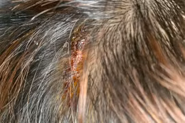 Thông tin mới vụ cô gái 16 tuổi bị chủ spa cắt tóc, đánh như nô lệ 