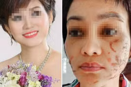 Thai phụ 7 tháng ở Hải Dương bị chồng đánh đập dã man, vết thương khắp người 