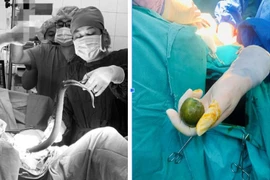 Nam thanh niên bị thủng trực tràng vì nhét lươn và chanh vào hậu môn