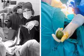 Nam thanh niên bị thủng trực tràng vì nhét lươn và chanh vào hậu môn